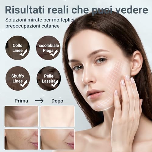 Velunelle - Massaggiatore Viso EMS 7 Colori